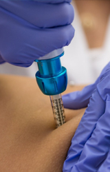 Intradermoterapia-Pressurizada
