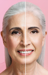 lift-facial