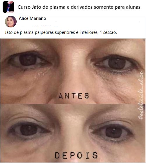 Resultado Jato de Plasma